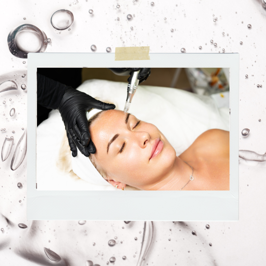 The Power Duo: Hyaluronic Acid + Microneedling for Radiant Skin