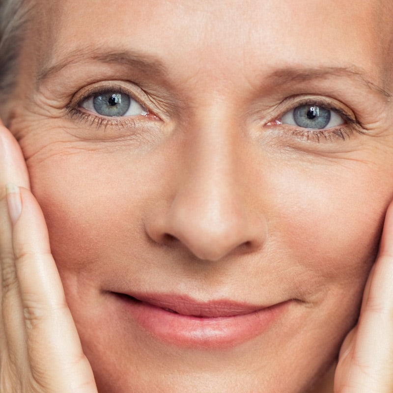 Fine Lines/Wrinkles