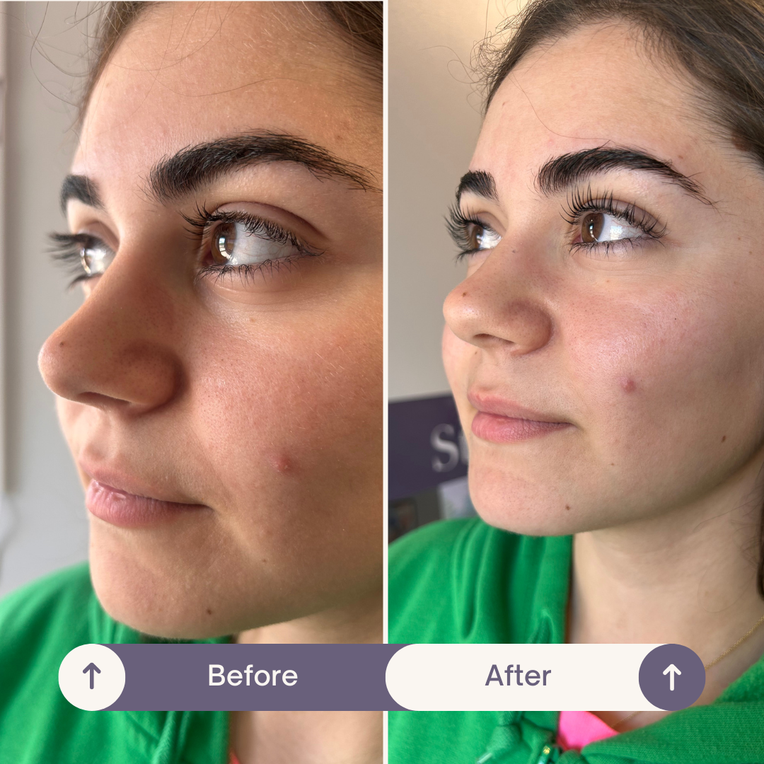 Stonhart Trifecta Lash & Brow Lamination