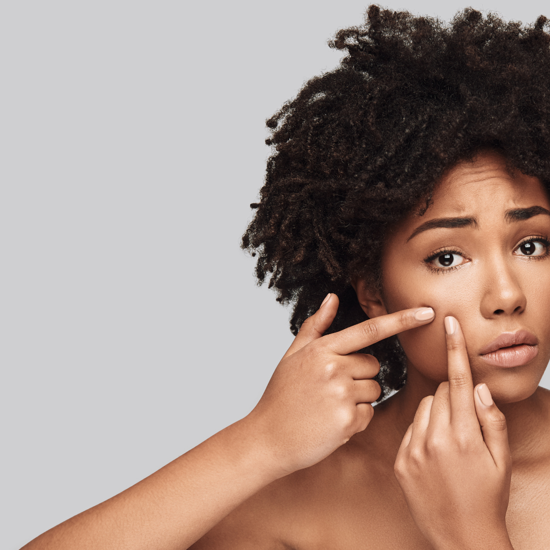 Treating Breakouts and Maskne