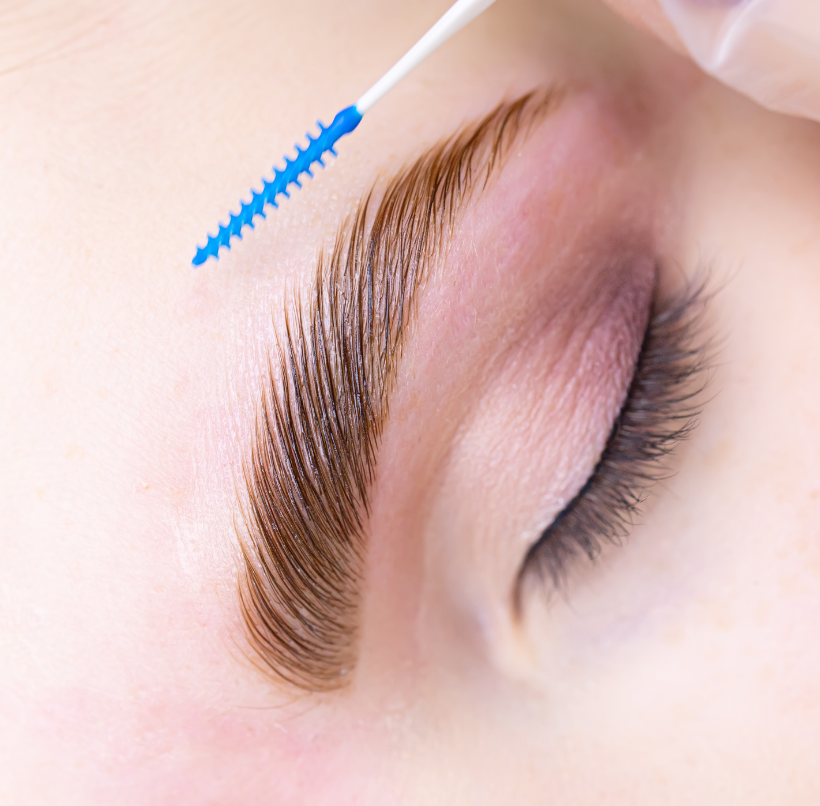 Brow Lift