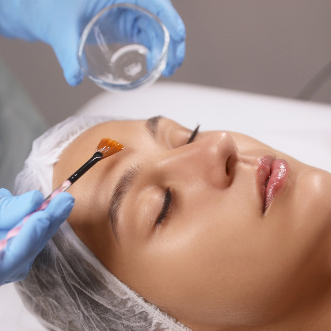 Chemical Peels and Enzymes