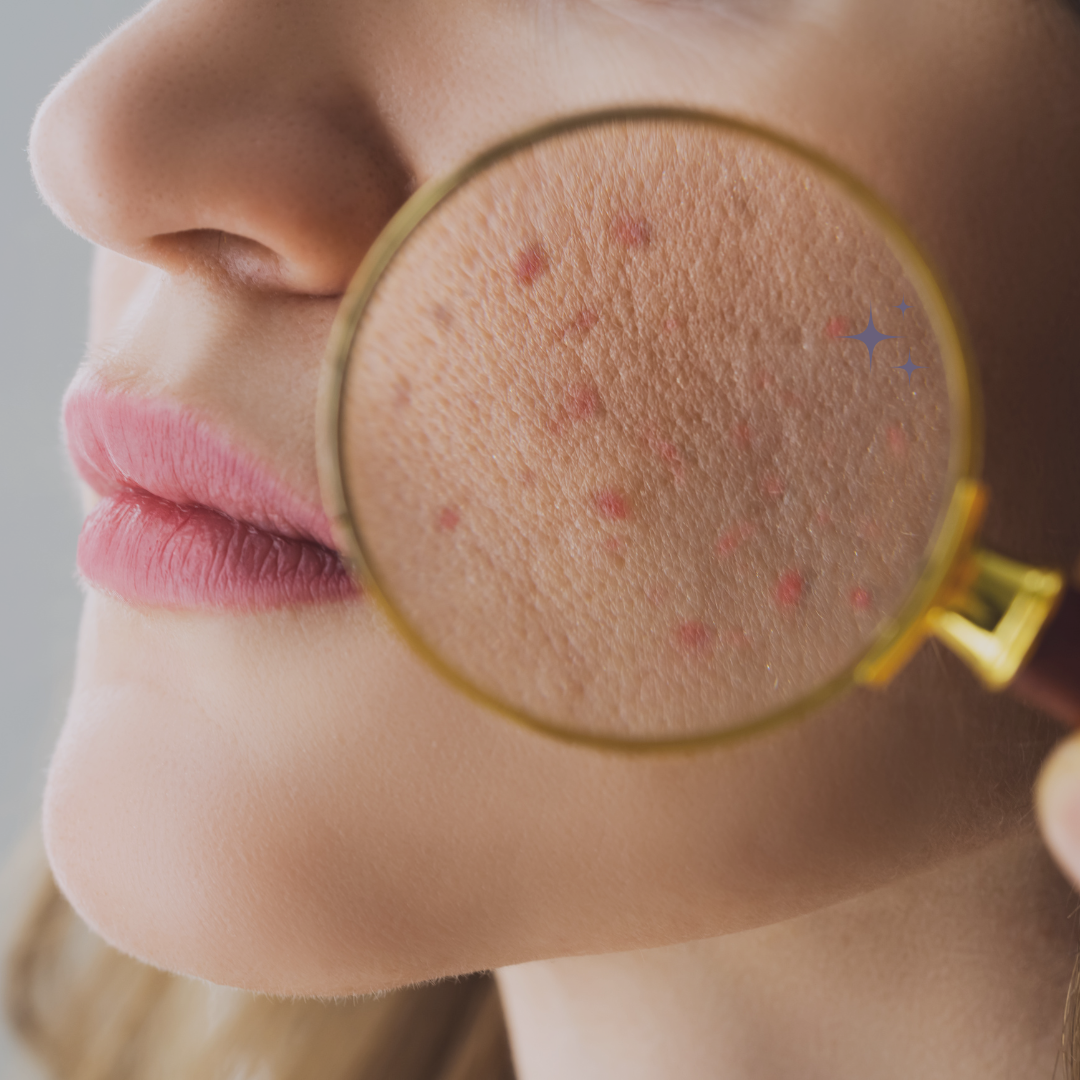 Skin Barrier Health and Repair Certification