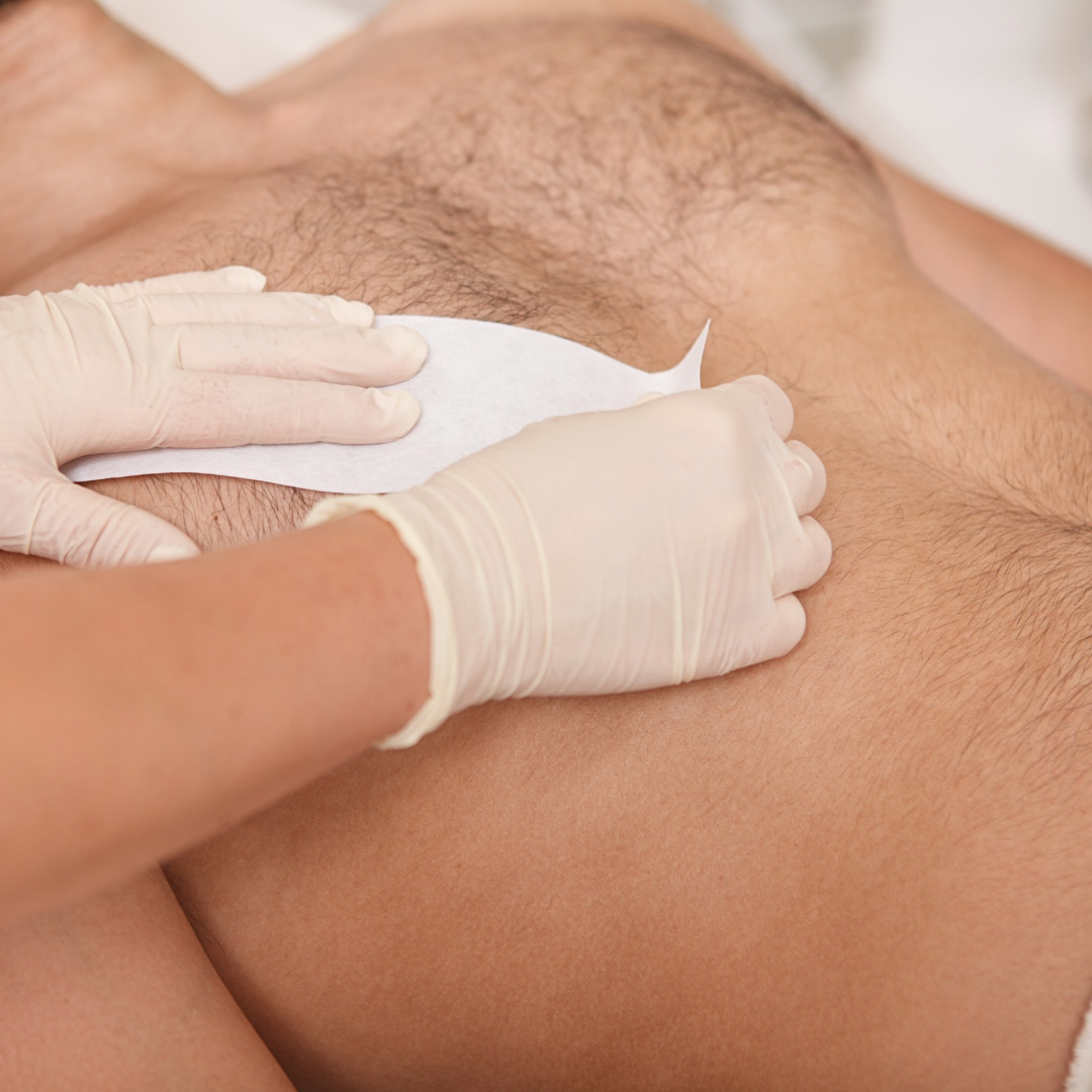 Back or Chest Wax in Student Clinic
