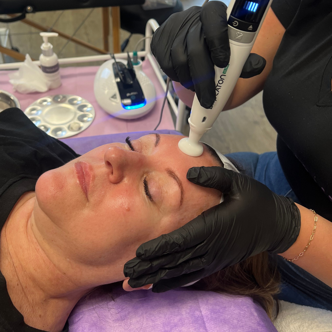 Stonhart Glass Skin with Cold Plasma Facial in Student Clinic