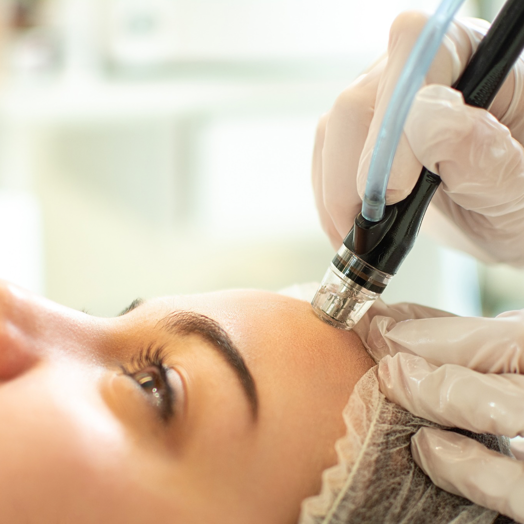 Stonhart Glow & Go Dermabrasion Facial in Student Clinic