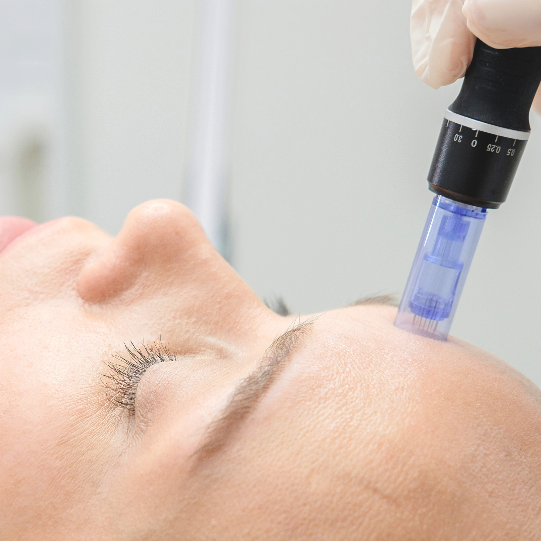 Microneedling Course in Reno, NV