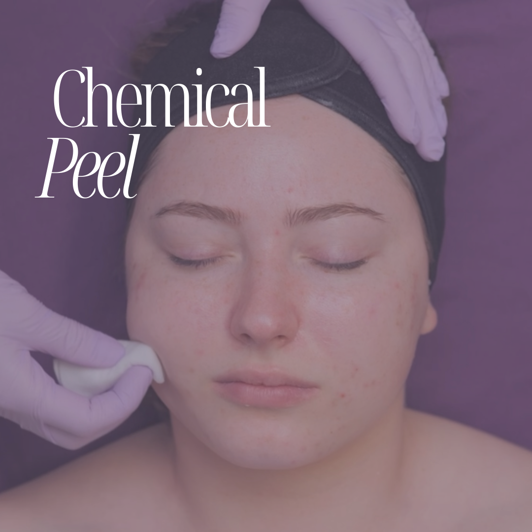 Mastering Chemical Peels Online Certification